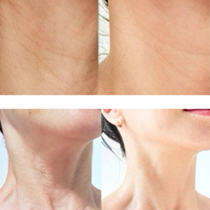 Translation missing: es.MEDIPEEL Premium 3.0 Collagen Naite Thread Neck Cream 100 ml-Crema para cuello y escote