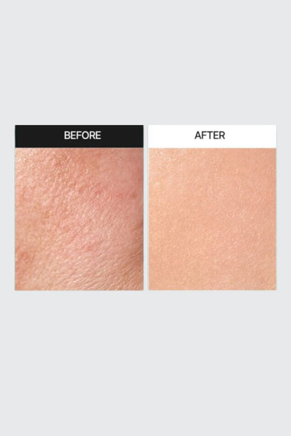Phyto Cica-Nol B5 3000 Shot Serum,50ml