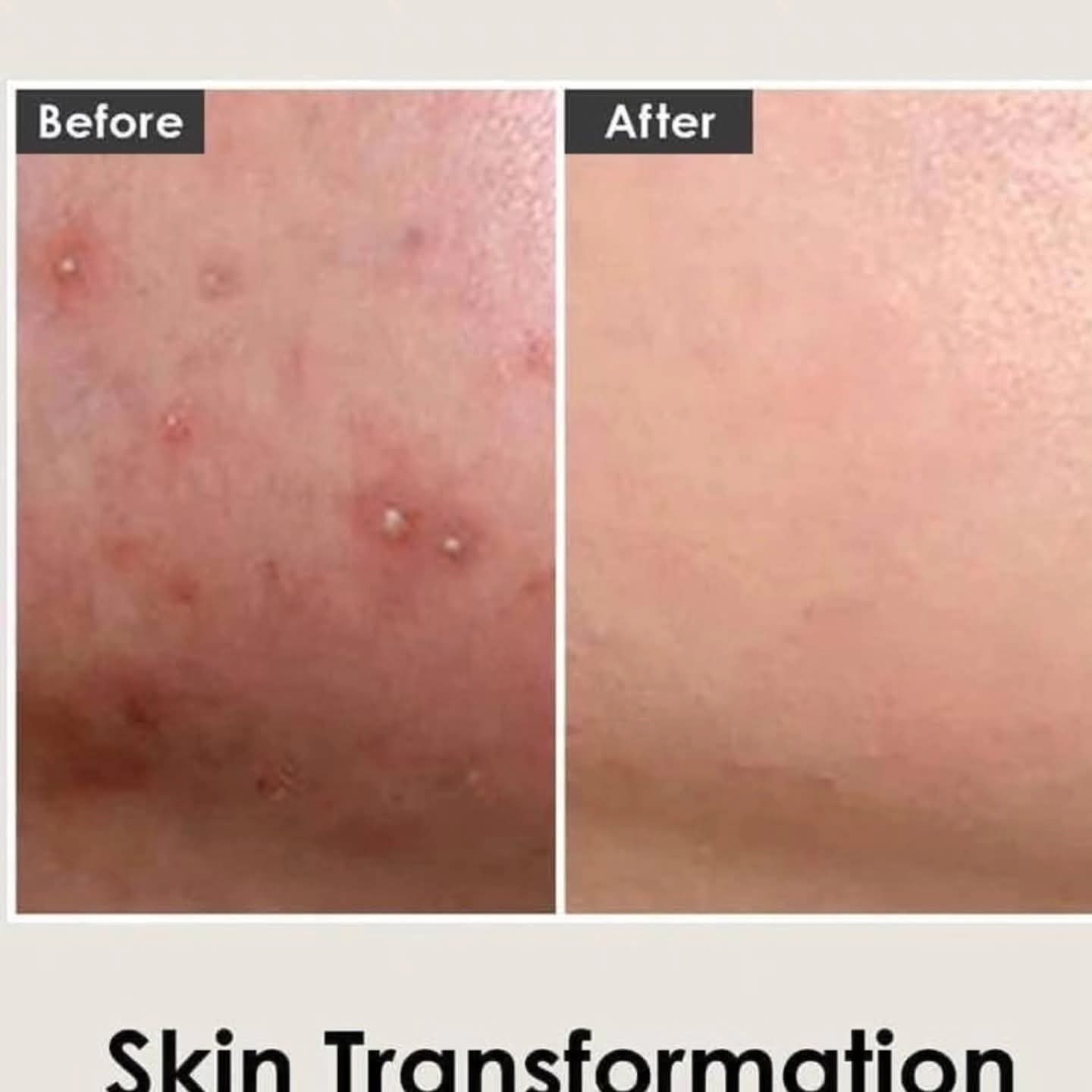 Cica Antio Cream, 30ml