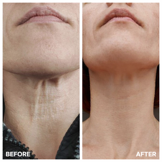 Translation missing: en.MEDIPEEL Premium Collagen Naite Thread Neck Cream 2.0 – Firming neck cream with collagen 100ml